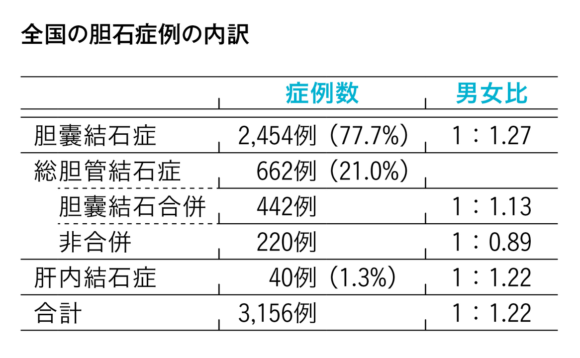 胆石症実