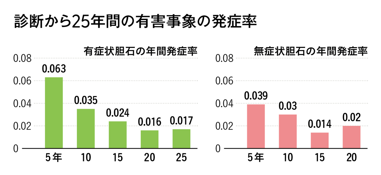 胆石症実