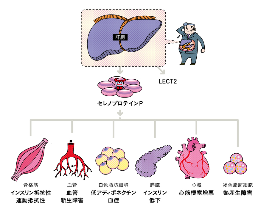 脂肪肝