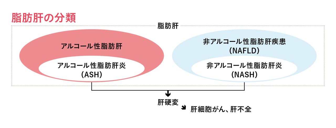 脂肪肝