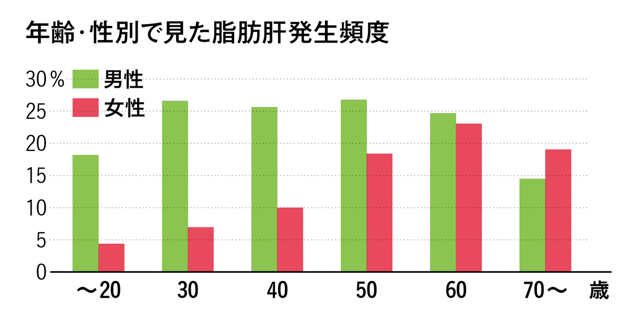 脂肪肝