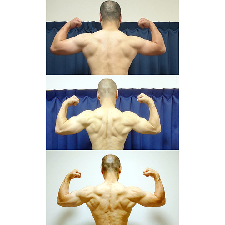 しげの背中のbefore/after