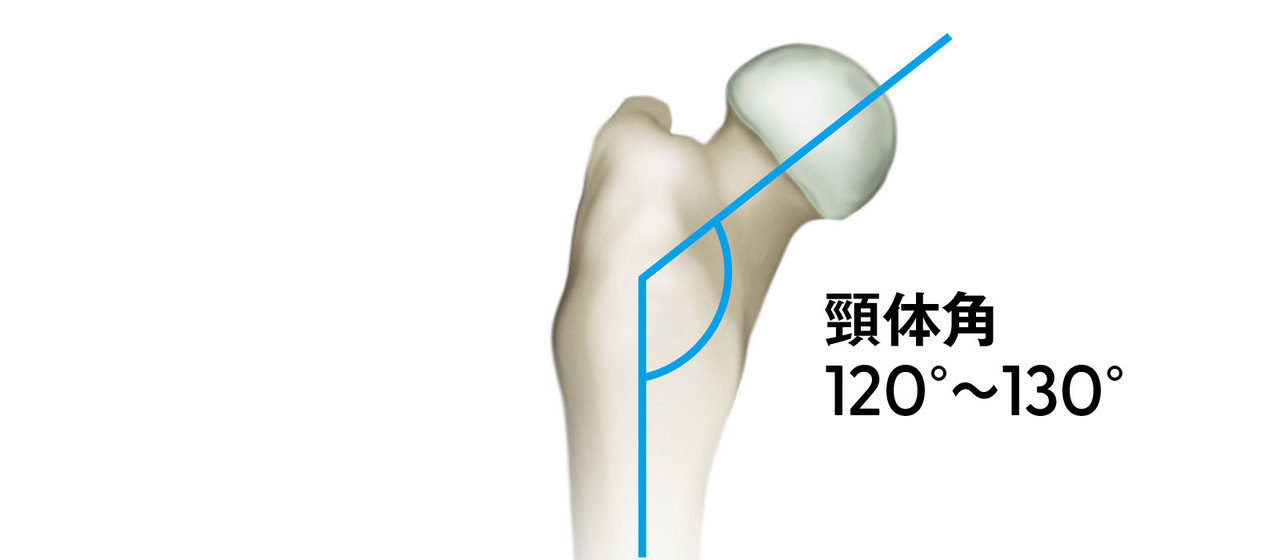 大腿骨の頸体角